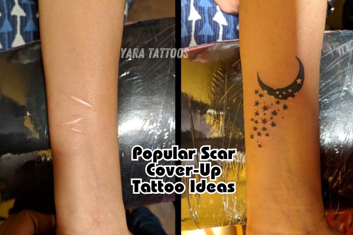 Before and After Scar Cover-Up Tattoo Featuring Moon and Stars – Yara Tattoos, Coimbatore